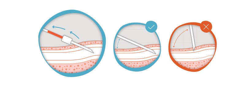 faktorkoncentrat-img