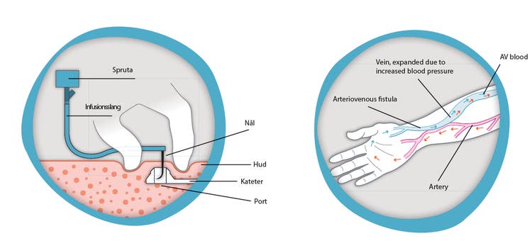 faktorkoncentrat-img